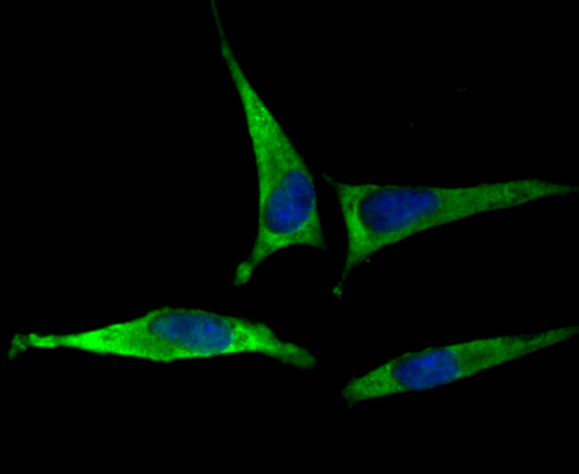 EAAT3 Rabbit mAb