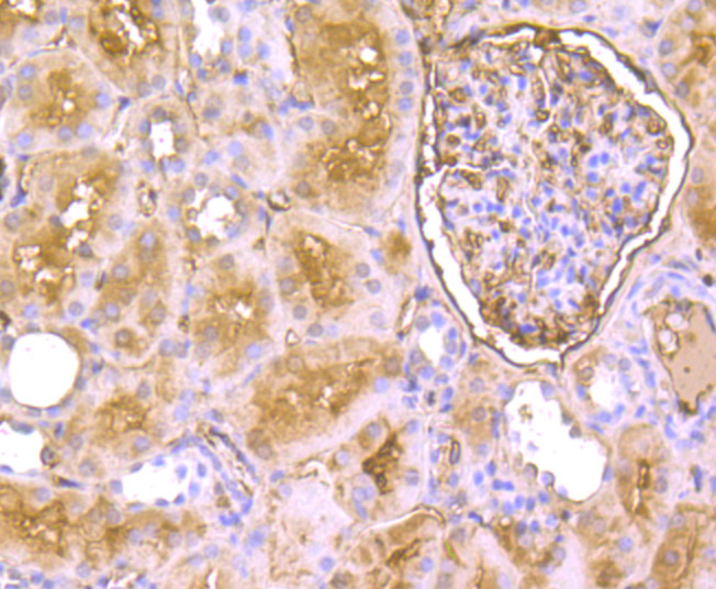 EAAT3 Rabbit mAb