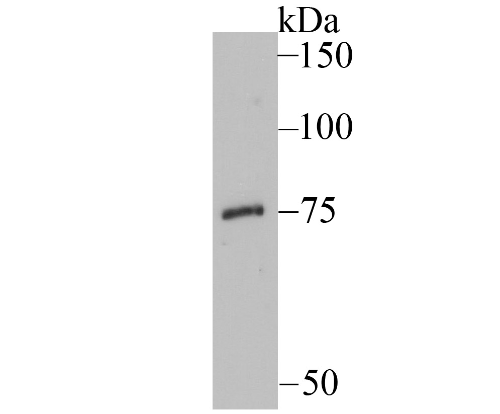 EAAT3 Rabbit mAb