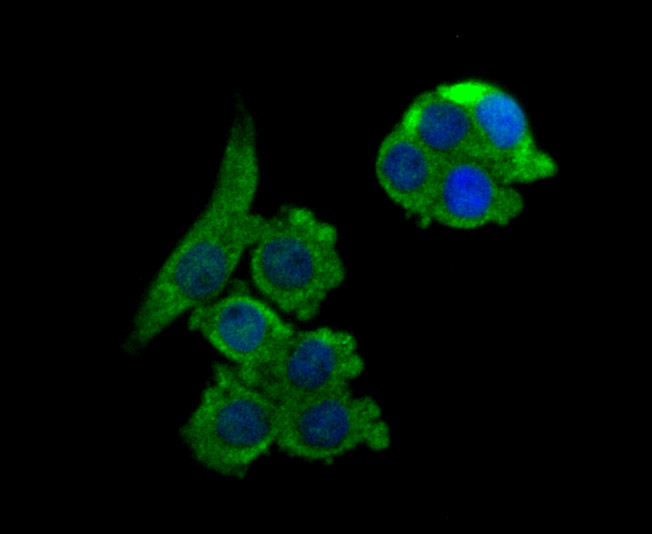 NCK1 Rabbit mAb