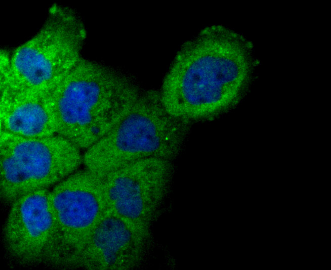 NCK1 Rabbit mAb