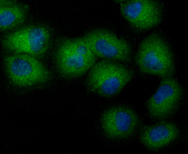 NCK1 Rabbit mAb