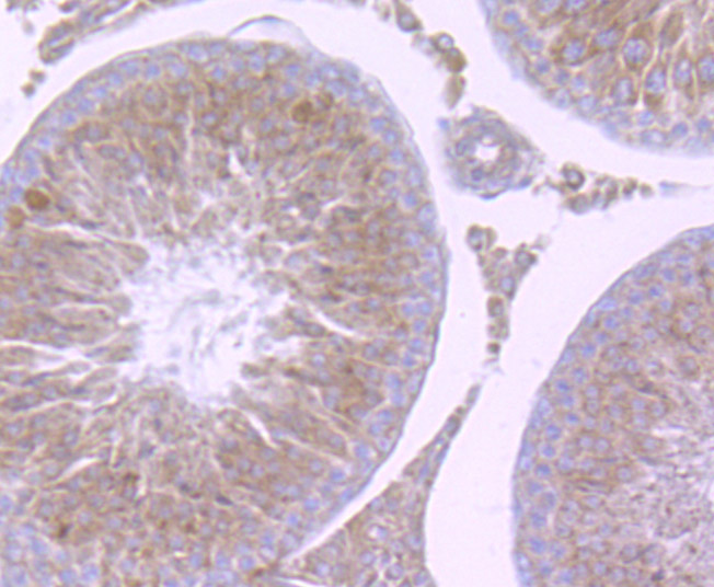 NCK1 Rabbit mAb