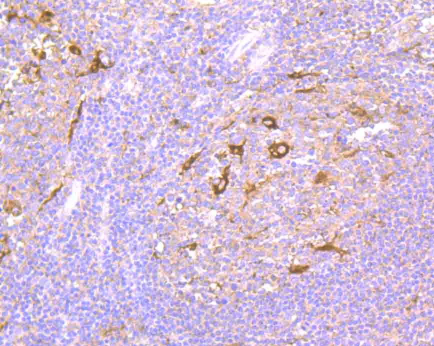 NCK1 Rabbit mAb