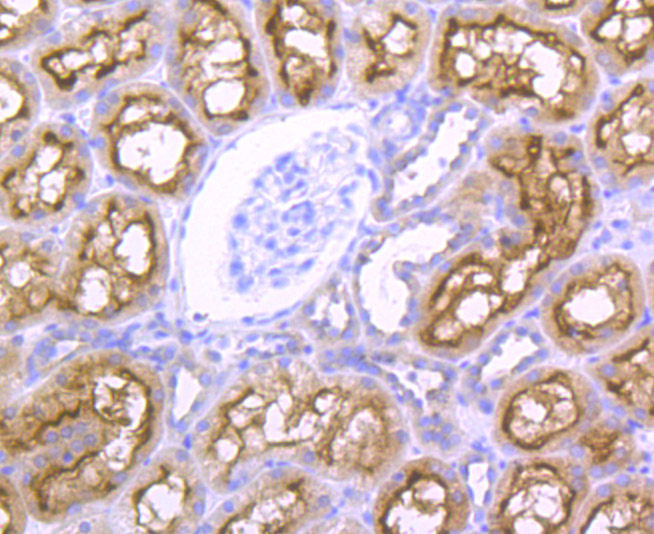 NCK1 Rabbit mAb