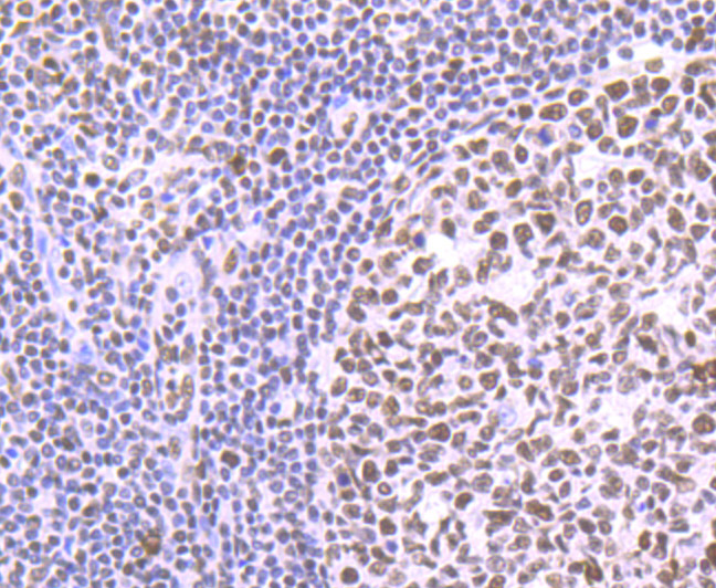 PTBP1 Rabbit mAb