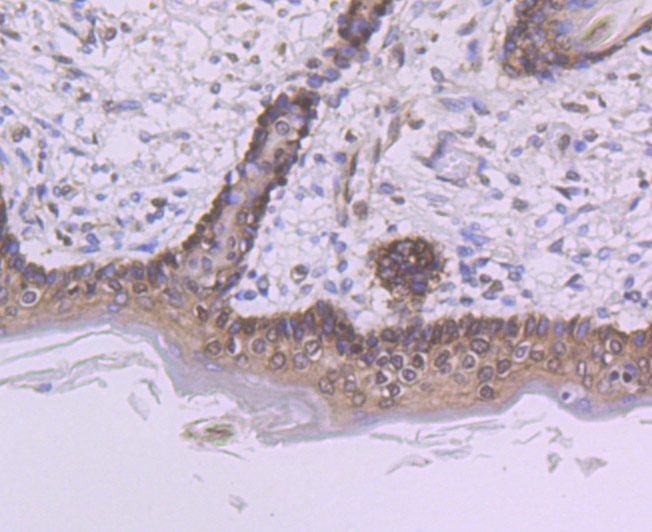 PTBP1 Rabbit mAb