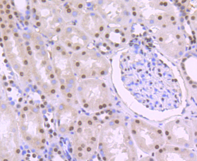 PTBP1 Rabbit mAb