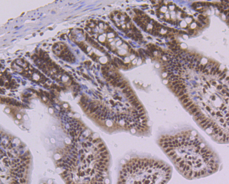 PTBP1 Rabbit mAb