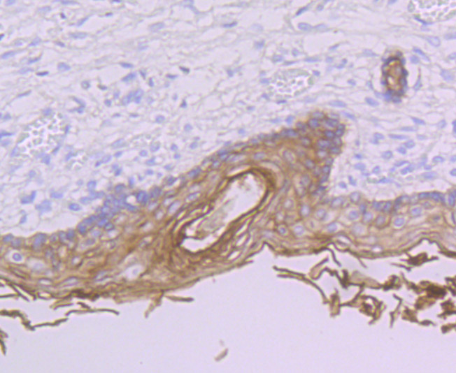 PERP Rabbit mAb