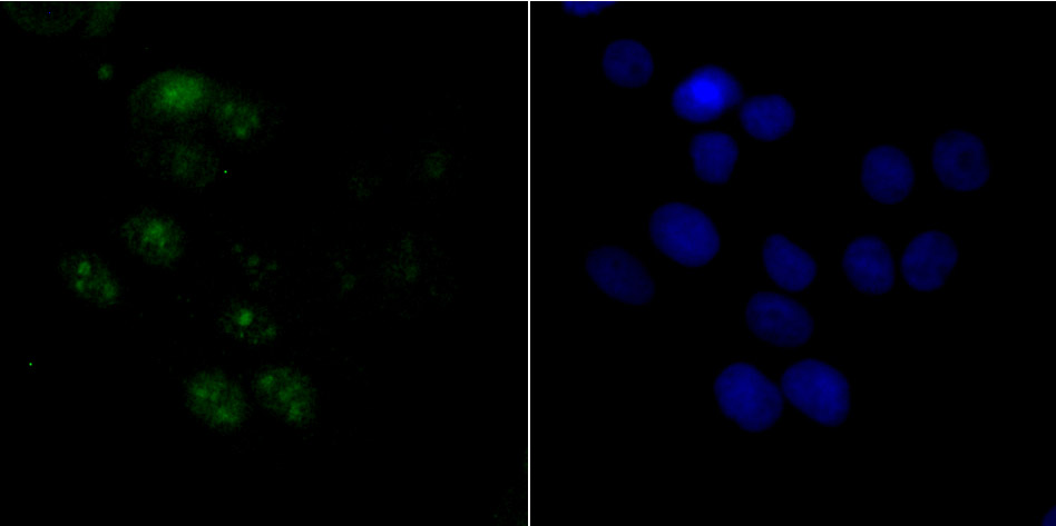 ACTL6A Rabbit mAb