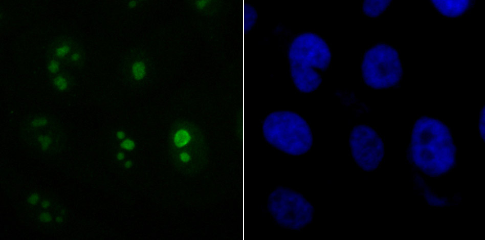 ACTL6A Rabbit mAb