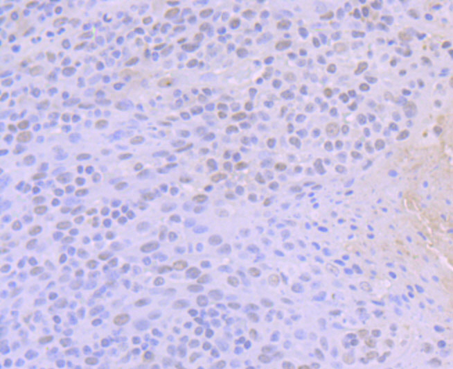 ACTL6A Rabbit mAb