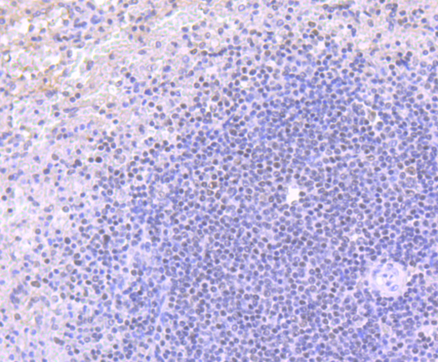 ACTL6A Rabbit mAb