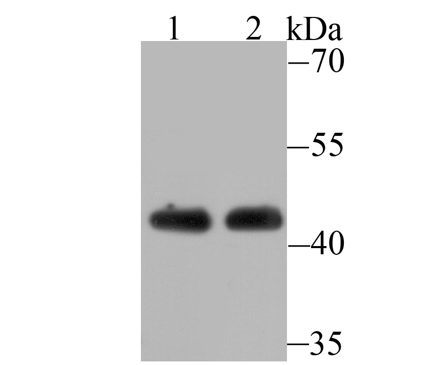 ACTL6A Rabbit mAb