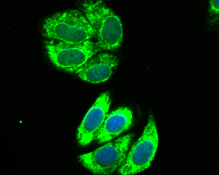 IL13 Receptor alpha 1 Rabbit mAb