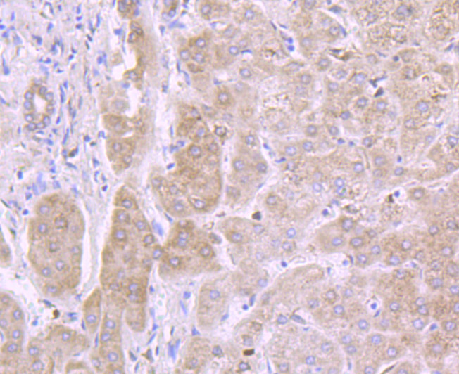 IL13 Receptor alpha 1 Rabbit mAb