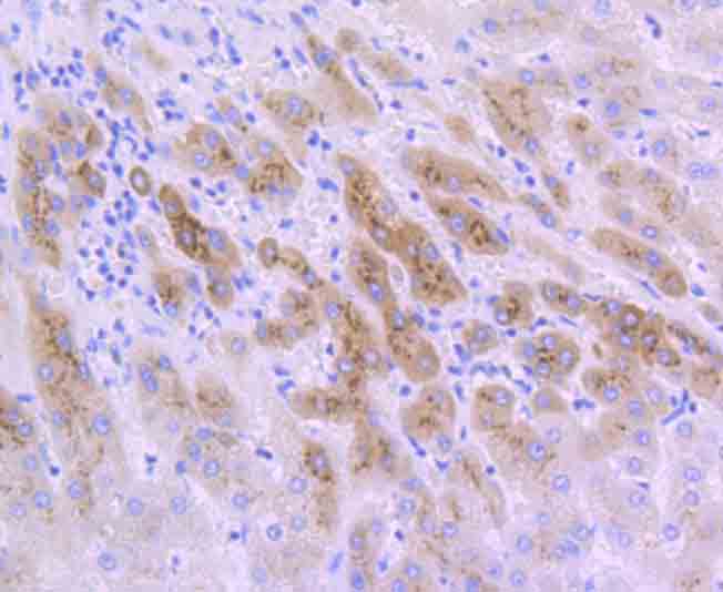 IGFBP2 Rabbit mAb