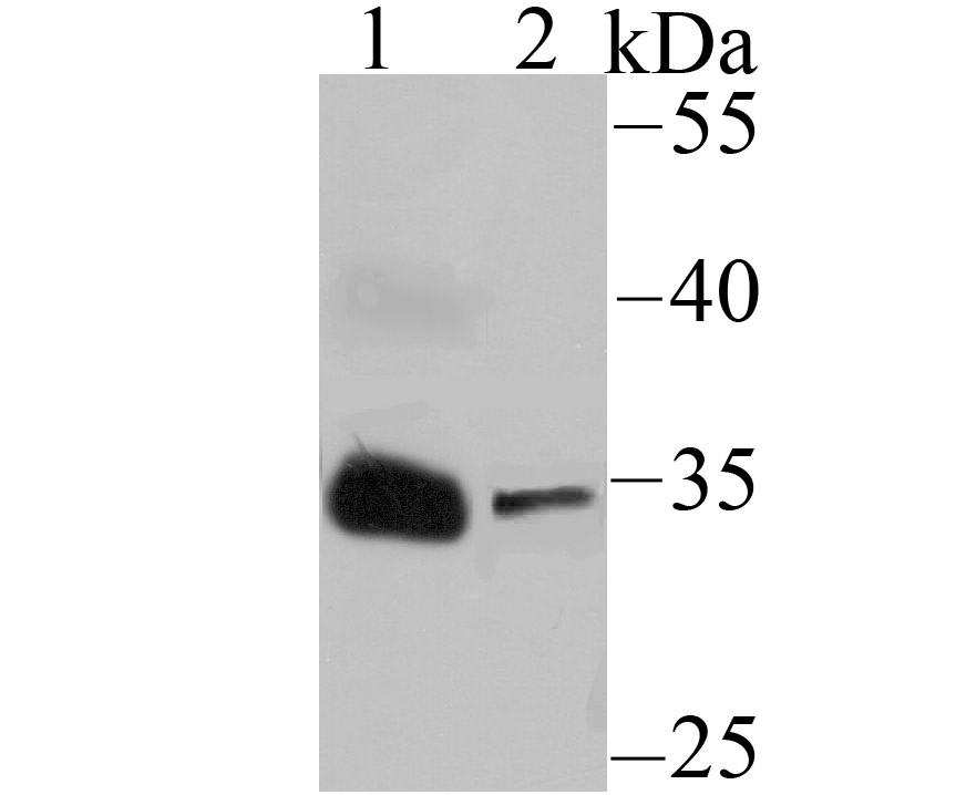 IGFBP2 Rabbit mAb