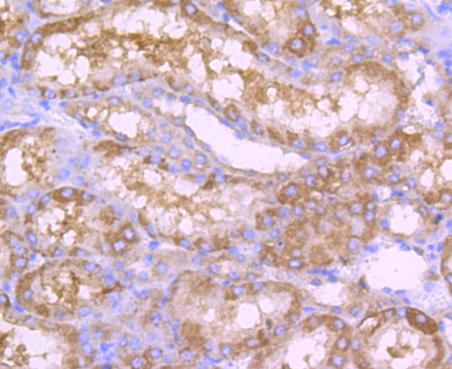 ALDH1L1 Rabbit mAb