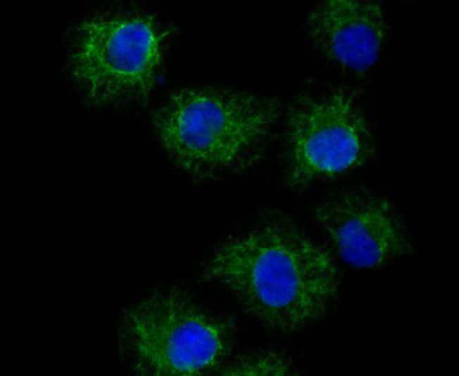 TRP1 Rabbit mAb