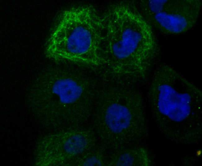 TRP1 Rabbit mAb