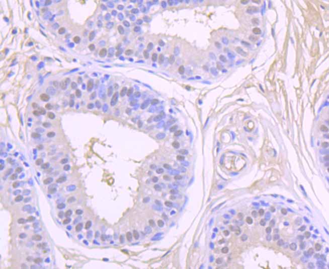 CSNK2B Rabbit mAb