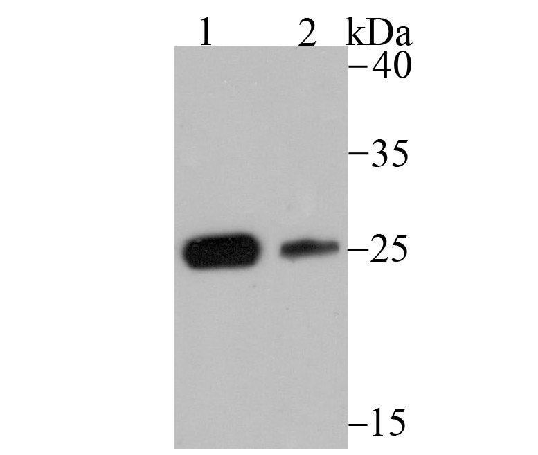 CSNK2B Rabbit mAb