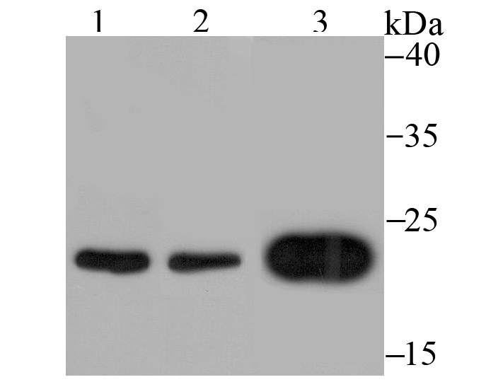 Mad2L1 Rabbit mAb