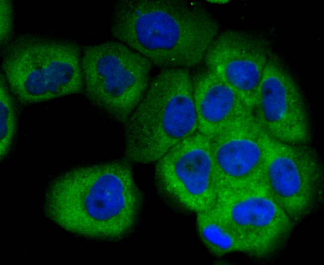 SCGB1A1 Rabbit mAb