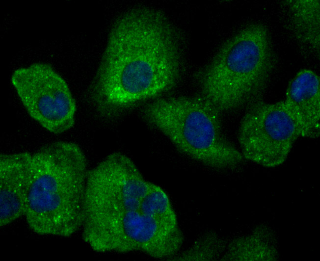 SCGB1A1 Rabbit mAb