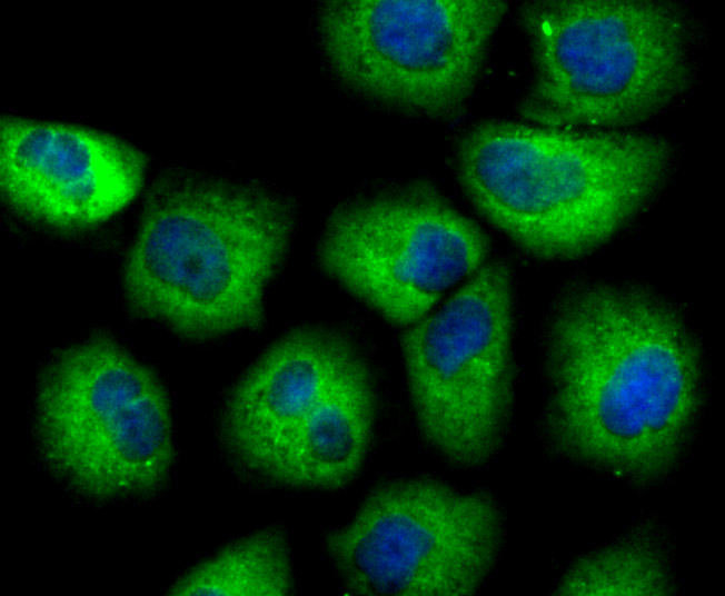 SCGB1A1 Rabbit mAb