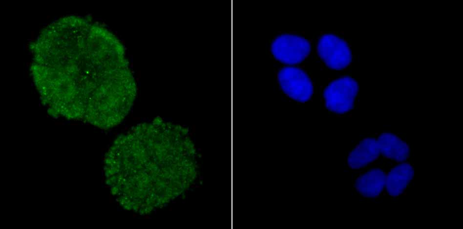 ADAR Rabbit mAb