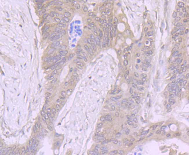 ADAR Rabbit mAb