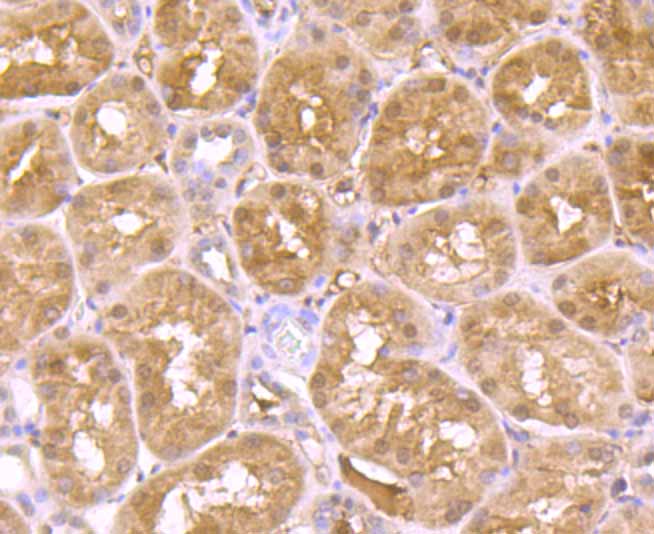 ADAR Rabbit mAb