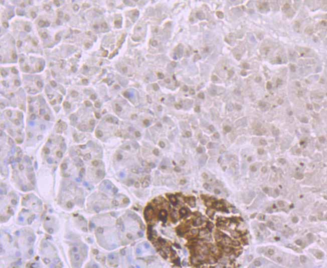 ADAR Rabbit mAb