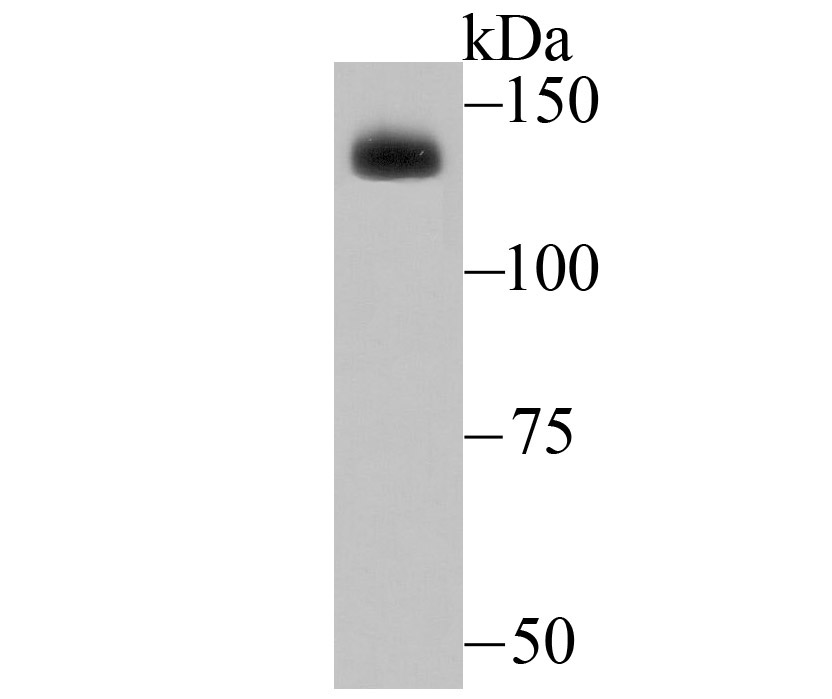 ADAR Rabbit mAb