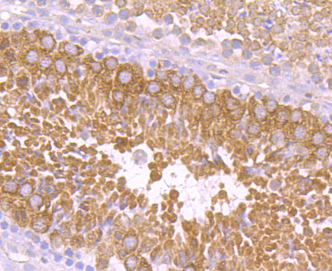 PIWIL1 Rabbit mAb