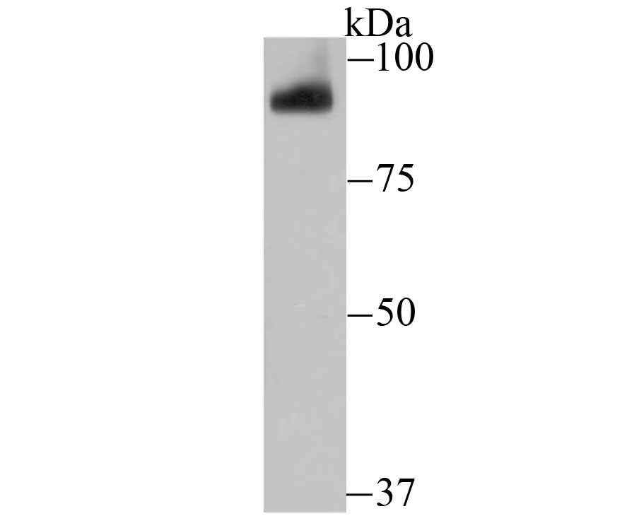 PIWIL1 Rabbit mAb