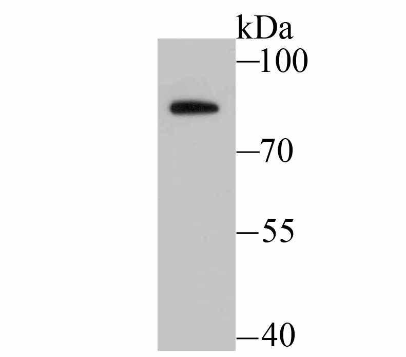 BDKRB2 Rabbit mAb