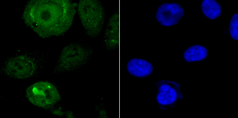 Endo G Rabbit mAb