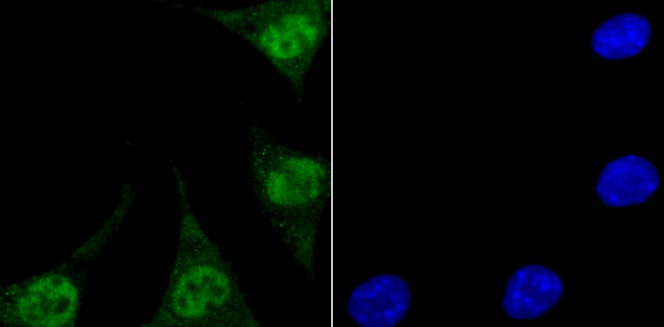 Endo G Rabbit mAb