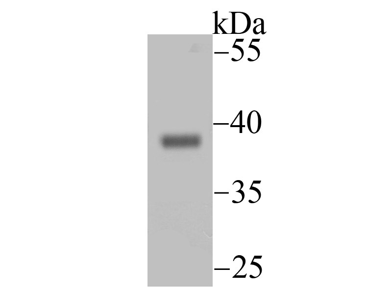 Endo G Rabbit mAb