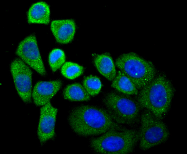 SEC23 Rabbit mAb