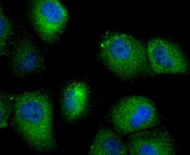 SEC23 Rabbit mAb