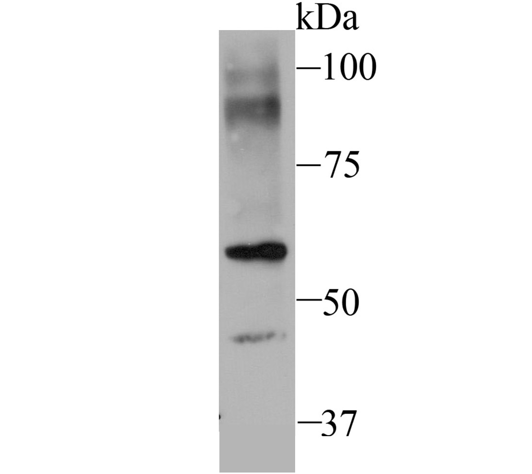 SEC23 Rabbit mAb