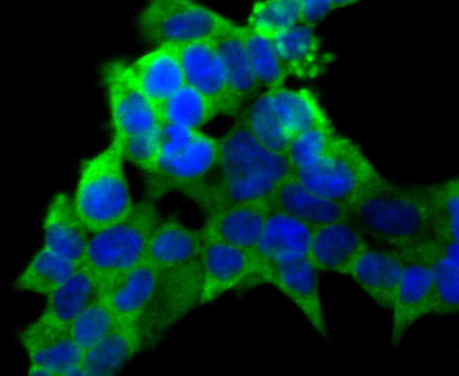 PCK1 Rabbit mAb