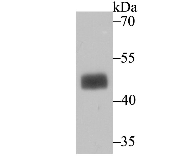 MAPKAP Kinase 2 Rabbit mAb