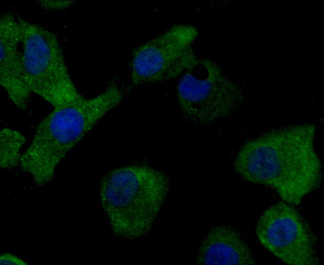 MMP17 Rabbit mAb