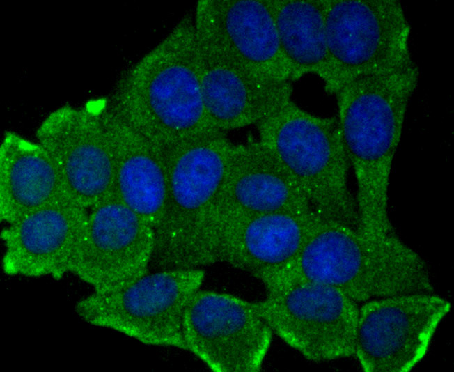 MMP17 Rabbit mAb